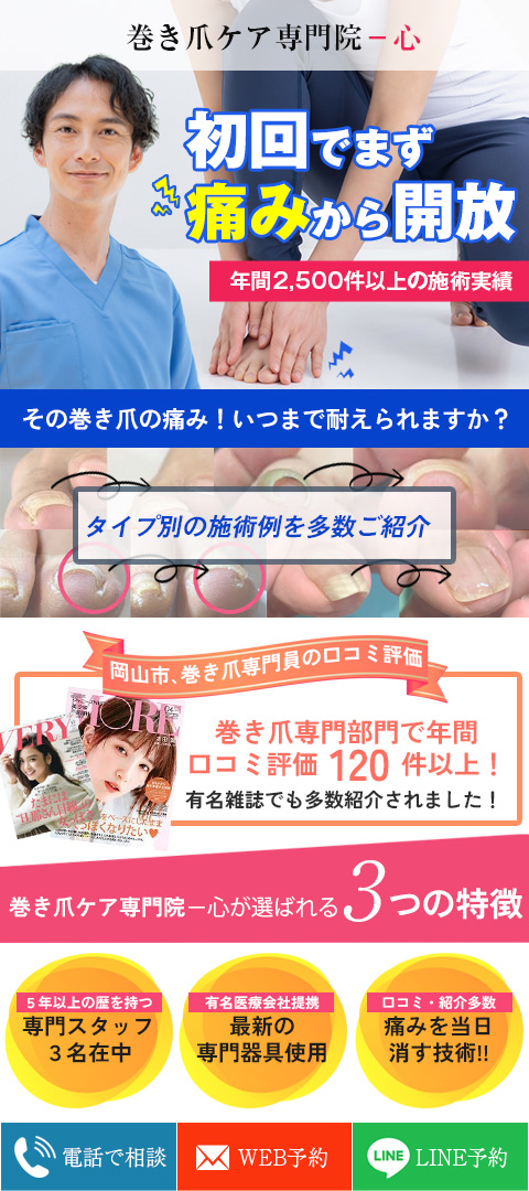 制作実績｜巻き爪ケア